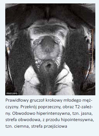Prostatitis kezelési konzultáció lehet prostatitis 23 C- on