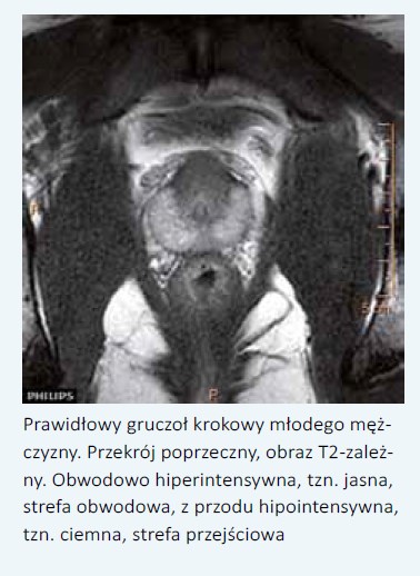 objętość prostaty norma