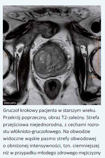 anatomia prostata pdf